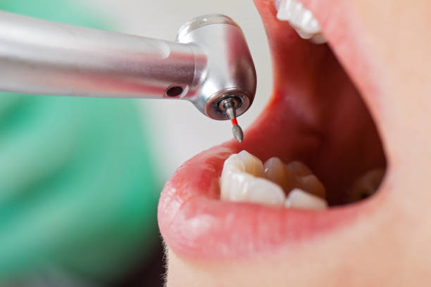 Emergency Dentist Open Today in MT